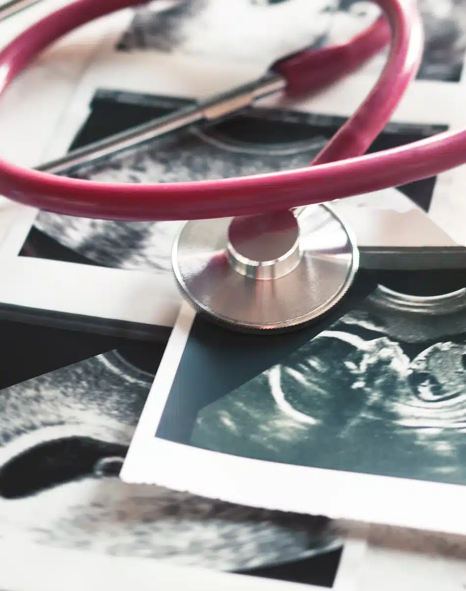 pink stethoscope resting on ultrasound pictures